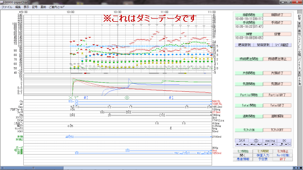 paperChart